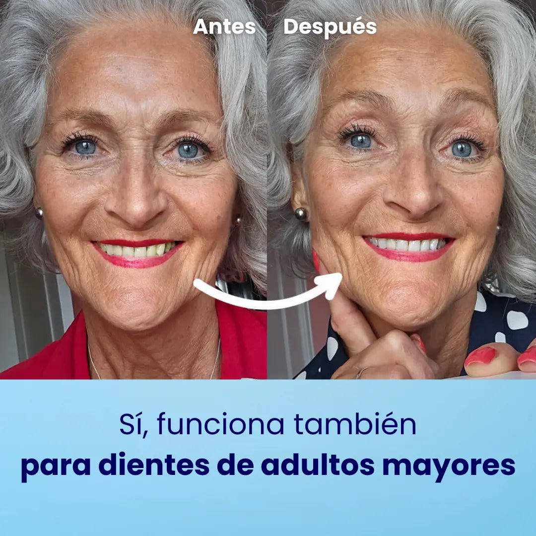 QROVE - Teeth Whitening Powder